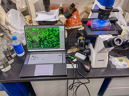 MSHOT Inverted Fluorescence Microscope Applied in Tianjin Institute of Hematology