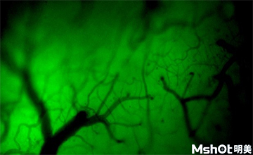 Fluorescence microscope helps China Medical University to observe the staining of living mice