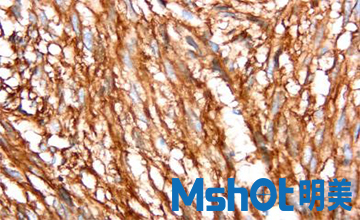 CMOS camera works for hospital to do immunohistochemical Report