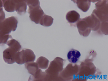 4血液中的白细胞观察的重要工具—广州明美自主研发的显微镜相机MD50.jpg
