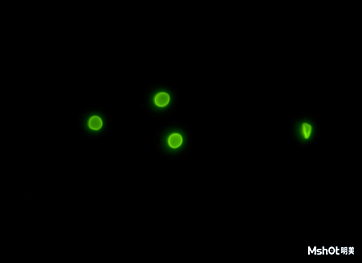 Cryptosporidium under fluorescence microscope.jpg