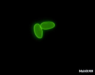 Giardia cysts under fluorescence microscope.jpg