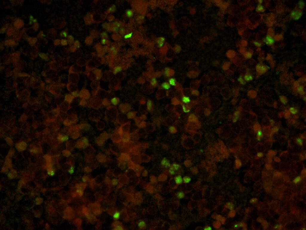 respiratory microscopy diagnosis