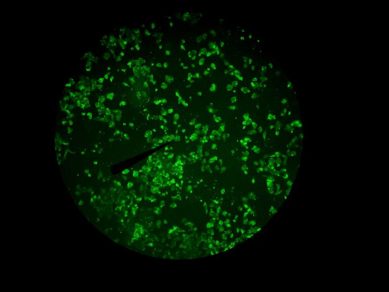 Green fluorescence in Zeiss PrimoStar3 eyepiece