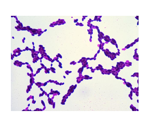 Gram stained fungus under bright field microscope 100X objective