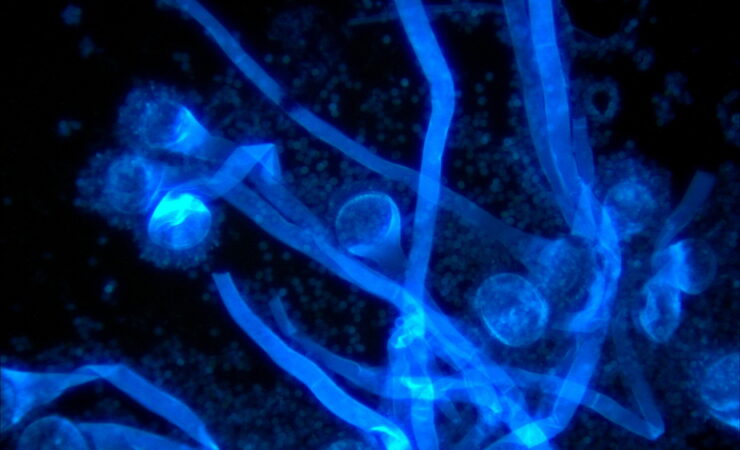 Fungus under fluorescence microscope