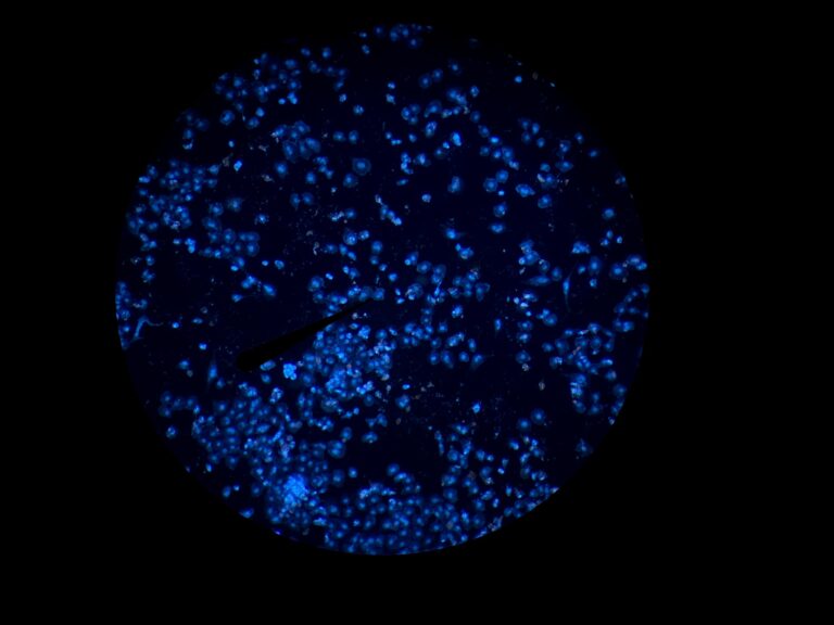 Blue fluorescence in Zeiss PrimoStar3 eyepiece