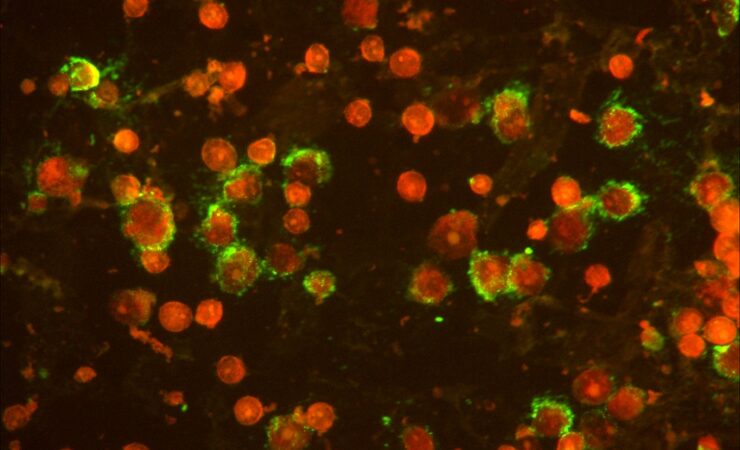 respiratory infection under fluorescence microscope