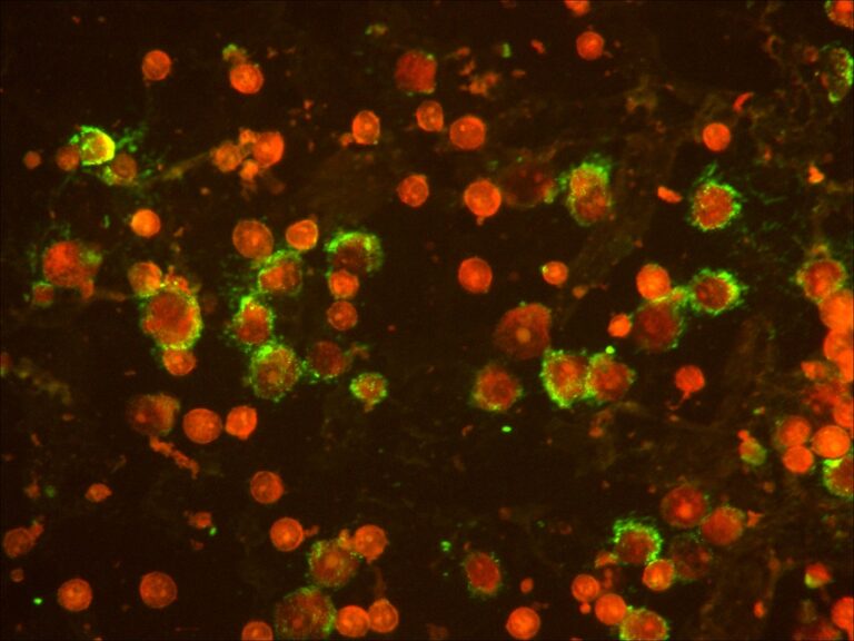 respiratory infection under fluorescence microscope