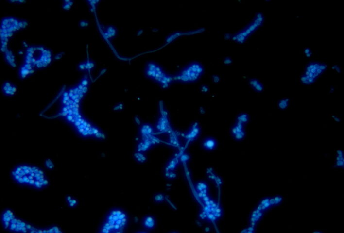 fungus candida under 40X objective