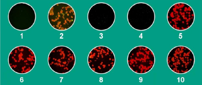 Negative results of respiratory infection speutum slide