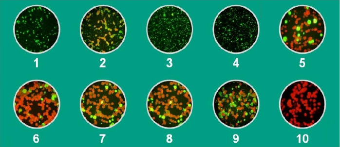 respiratory track microscope diagnosis positive results