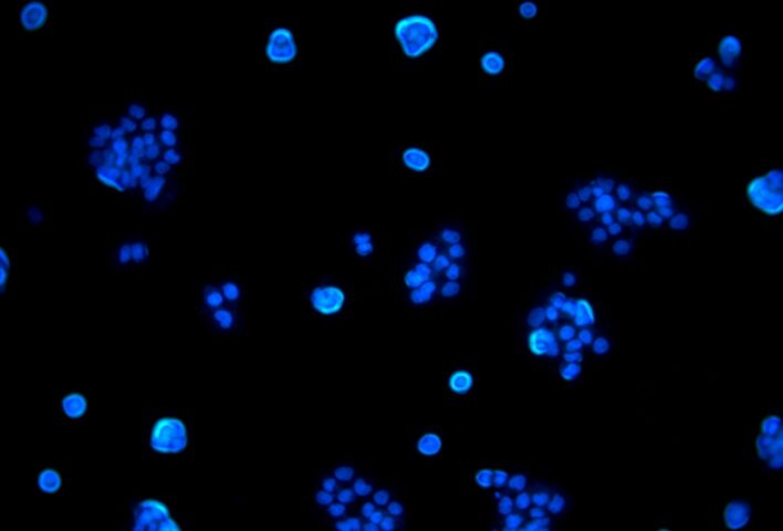 Live cell DAPI stain