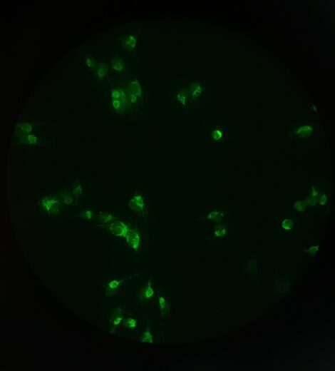 Green fluorescence in eyepiece of Nikon Eclipse microscope with MF-LED module