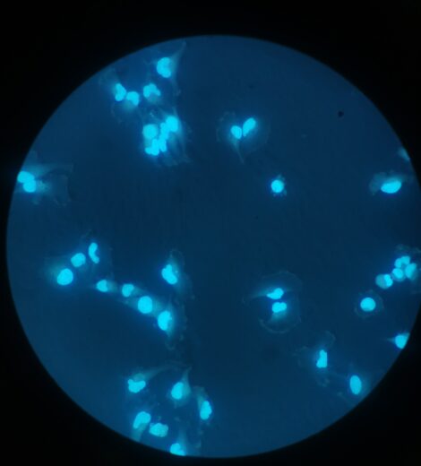 blue fluorescence in Nikon Si and Ci eyepiece by MF-LED module