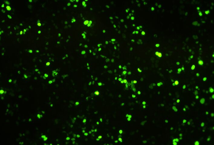 GFP stain cells in green fluorescence